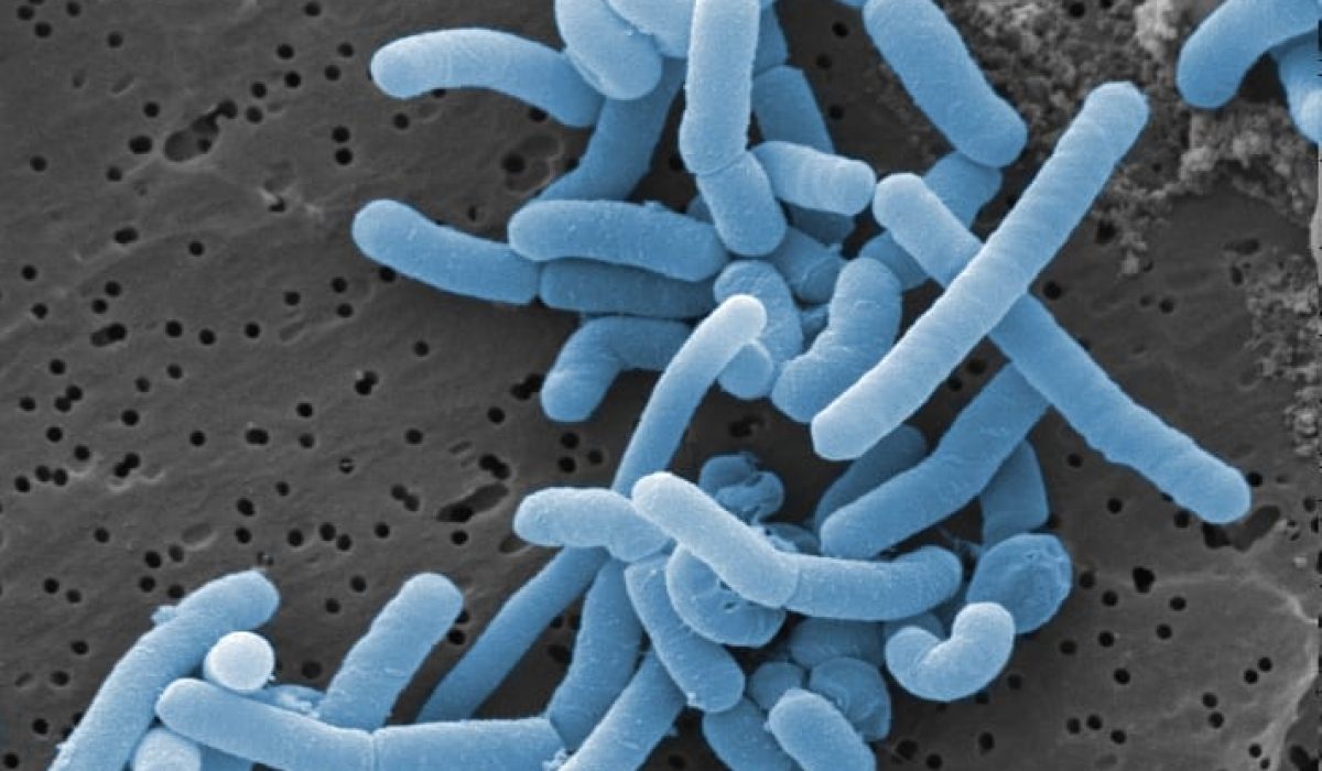 Mikroba pengurai septic tank